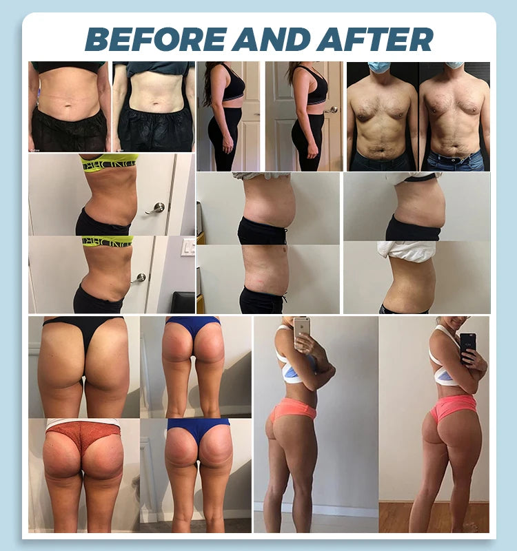 MYOslim EMS Body Building Machine RF Fat Removal 2 Handles Muscle Sculpting Body Muscle Stimulation for Fitness And Wellness