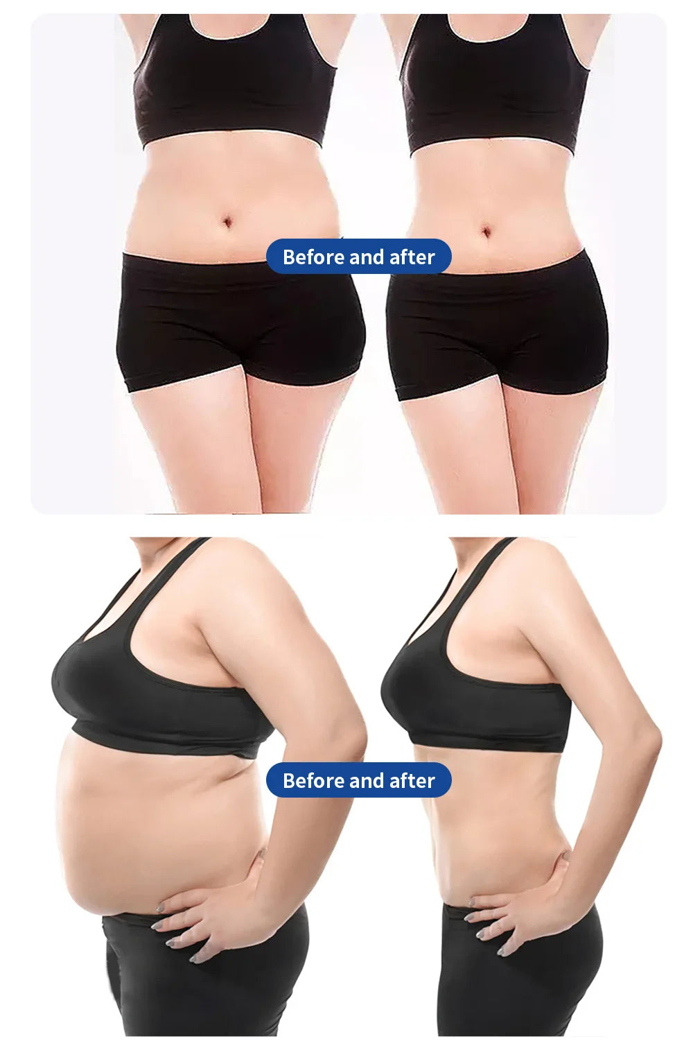 MYOslim EMS Body Building Machine RF Fat Removal 2 Handles Muscle Sculpting Body Muscle Stimulation for Fitness And Wellness